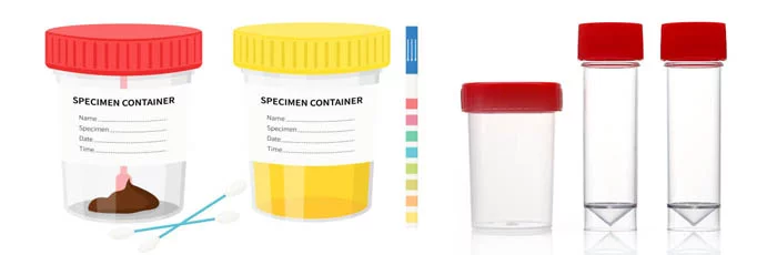 urine container mold 1 urine container mold-1