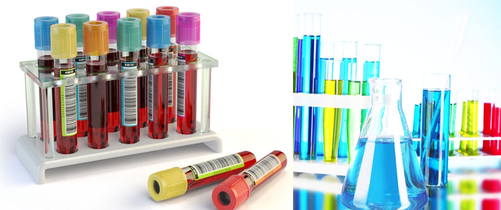 What is virus sampling storage tube What is virus sampling storage tube