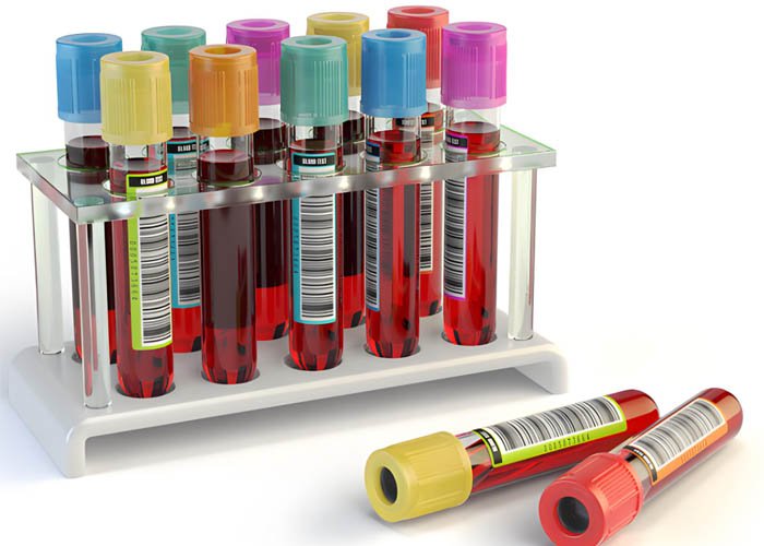 solutions for blood collection tube molds